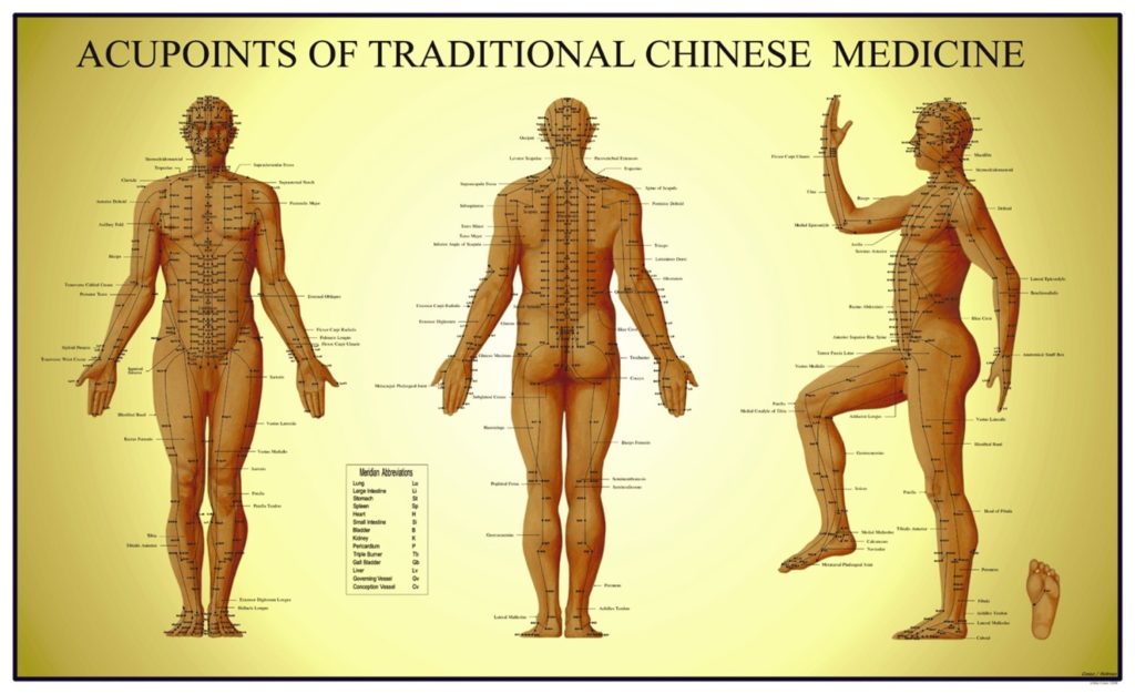 sciatica acupuncture