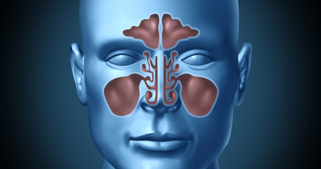 pulmonary embolism