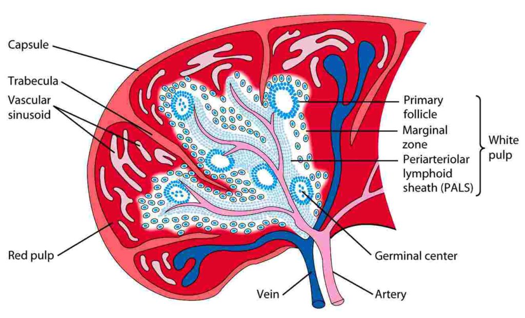 sickle cell disease splenic sequestration